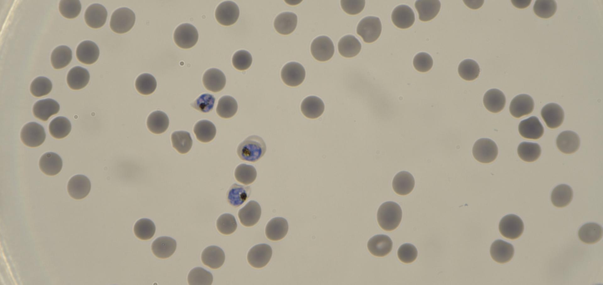 P. falciparum